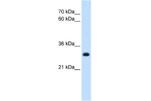 WB Suggested Anti-TAL1 Antibody   Titration: 5 ug/ml   Positive Control: HepG2 Whole Cell (TAL1 Antikörper  (Middle Region))