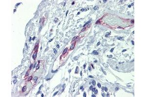 EHD4 antibody was used for immunohistochemistry at a concentration of 4-8 ug/ml. (EHD4 Antikörper  (Middle Region))