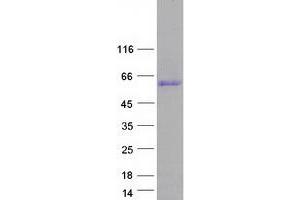 CCDC85C Protein (Myc-DYKDDDDK Tag)