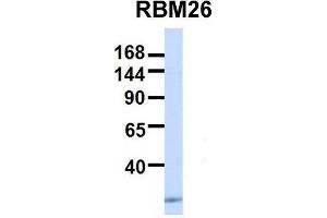 Host:  Rabbit  Target Name:  RBM26  Sample Type:  Human 293T  Antibody Dilution:  1. (RBM26 Antikörper  (Middle Region))