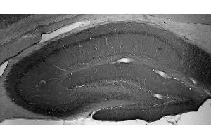 Adult rat hippocampus immunohistochemistry.