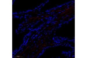 Immunofluorescence of paraffin embedded human prostate using paldadin (ABIN7074976) at dilution of 1: 500 (300x lens) (PALLD Antikörper)