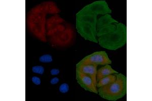 ABIN6259321 and ABIN6274774 staining Hela cells by IF/ICC. (RPL26L Antikörper  (C-Term))