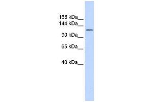 WB Suggested Anti-SLC24A1 Antibody Titration:  0. (SLC24A1 Antikörper  (Middle Region))