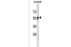 SPAM1 Antikörper  (C-Term)