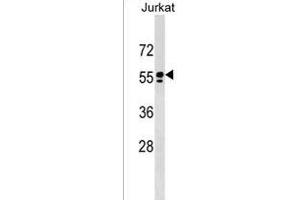 SM1 Antibody (C-term)  western blot analysis in Jurkat cell line lysates (35 μg/lane). (SPAM1 Antikörper  (C-Term))