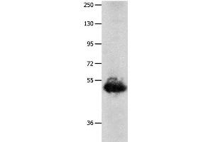 Western Blot analysis of Human lung cancer tissue using BPIFB3 Polyclonal Antibody at dilution of 1:1600 (BPIFB3 Antikörper)