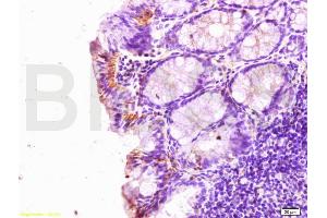 Formalin-fixed and paraffin embedded rat colitis labeled with Rabbit Anti SLC40A1 Polyclonal Antibody, Unconjugated (ABIN701095) at 1:200 followed by conjugation to the secondary antibody and DAB staining (SLC40A1 Antikörper)