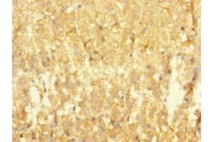 Immunohistochemistry of paraffin-embedded human adrenal gland tissue using ABIN7167753 at dilution of 1:100 (RTN4IP1 Antikörper  (AA 41-396))