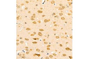 Immunohistochemistry of paraffin embedded mouse brain using ptgds (ABIN7075207) at dilution of 1:1700 (400x lens)