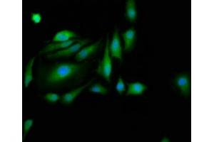 Immunofluorescence staining of Hela cells with ABIN7162684 at 1:200, counter-stained with DAPI. (PASK Antikörper  (AA 482-602))