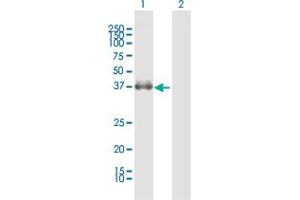 Western Blotting (WB) image for anti-Fc Fragment of IgG, Low Affinity IIb, Receptor (CD32) (FCGR2B) (AA 1-310) antibody (ABIN515565)