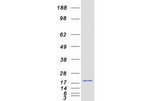 Validation with Western Blot