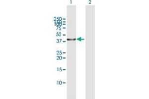Western Blot analysis of SERPINB3 expression in transfected 293T cell line by SERPINB3 MaxPab polyclonal antibody. (SERPINB3 Antikörper  (AA 1-390))