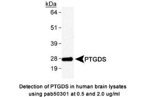 Image no. 1 for anti-Prostaglandin D2 Synthase (PTGDS) antibody (ABIN363610) (PTGDS Antikörper)