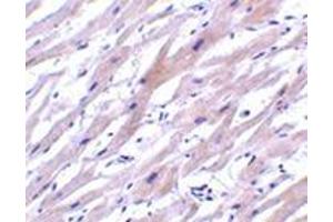 Immunohistochemistry of UNG1 in human heart tissue with this product at 2 μg/ml. (UNG Antikörper  (N-Term))