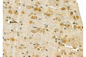 ABIN6258799 and ABIN6275949 at 1/100 staining Rat brain tissue by IHC-P.