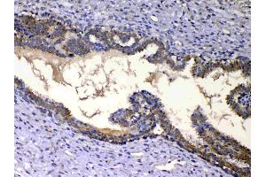 Immunohistochemistry (IHC) image for anti-Insulin-Like Growth Factor Binding Protein 2, 36kDa (IGFBP2) (AA 36-325) antibody (ABIN5519003)