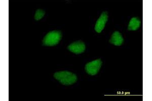 Immunofluorescence of purified MaxPab antibody to STK36 on HeLa cell.