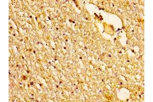 IHC image of ABIN7160954 diluted at 1:200 and staining in paraffin-embedded human brain tissue performed on a Leica BondTM system.