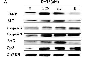 Apoptosis related proteins were detected in EOMA cells after treated with DHTS and propranolol. (PARP1 Antikörper  (AA 81-390))