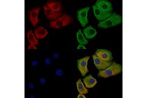 Phospho-Paxillin (Ser178) Antibody staining Hela cells(heat shock treatment) by IF/ICC. (Paxillin Antikörper  (pSer178))