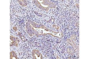 IHC analysis of Glutaminase/GLS using anti-Glutaminase/GLS antibody (ABIN7601601).