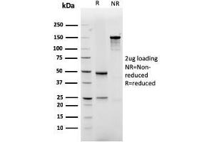 SDS-PAGE Analysis Purified GLUT-1 Recombinant Mouse Monoclonal Antibody (rGLUT1/2476).