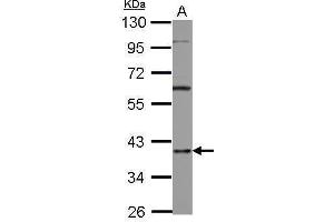 WB Image Sample (30 ug of whole cell lysate) A: A431 10% SDS PAGE antibody diluted at 1:1000 (HNRNPD/AUF1 Antikörper)