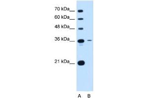 Tetraspanin 5 antibody used at 0. (Tetraspanin 5 Antikörper  (Middle Region))