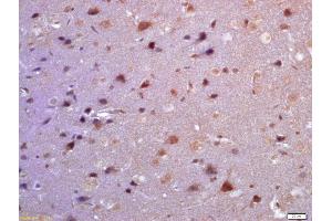 Immunohistochemistry (IHC) image for anti-Pleckstrin Homology-Like Domain, Family A, Member 2 (PHLDA2) (AA 31-80) antibody (ABIN872459)