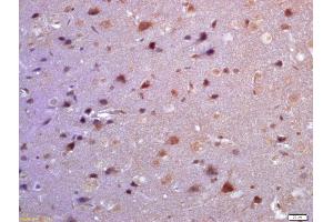 Formalin-fixed and paraffin embedded rat brain labeled with Anti-TSSC3 Polyclonal Antibody, Unconjugated (ABIN872459) at 1:200 followed by conjugation to the secondary antibody and DAB staining (PHLDA2 Antikörper  (AA 31-80))