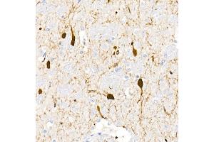 Immunohistochemistry of paraffin-embedded rat brain using DDC Rabbit pAb (ABIN1679510, ABIN3018150, ABIN3018151 and ABIN6220384) at dilution of 1:25 (40x lens). (DDC Antikörper  (AA 1-100))