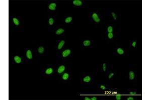 Image no. 3 for anti-DEAD (Asp-Glu-Ala-Asp) Box Polypeptide 54 (DDX54) (AA 778-882) antibody (ABIN599302) (DDX54 Antikörper  (AA 778-882))