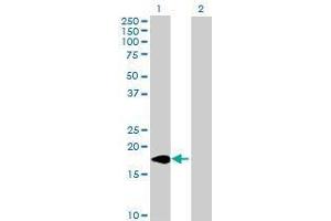 Lane 1: ARL2BP transfected lysate ( 18.