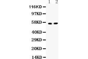 Anti-  ICA1 Picoband antibody, Western blottingAll lanes: Anti ICA1  at 0. (ICA1 Antikörper  (Middle Region))