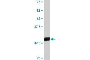 Western Blot detection against Immunogen (38. (CXCL5 Antikörper  (AA 1-114))