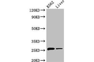 Western Blot Positive WB detected in: K562 whole cell lysate, Mouse liver tissue All lanes: NQO2 antibody at 3 μg/mL Secondary Goat polyclonal to rabbit IgG at 1/50000 dilution Predicted band size: 26 kDa Observed band size: 26 kDa (NQO2 Antikörper  (AA 1-231))