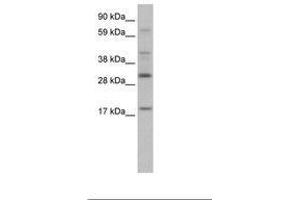 Image no. 1 for anti-PYD and CARD Domain Containing (PYCARD) (AA 71-120) antibody (ABIN202052) (PYCARD Antikörper  (AA 71-120))