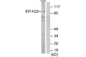 Western blot analysis of extracts from A549 cells, using EIF4G2 antibody. (EIF4G2 Antikörper)