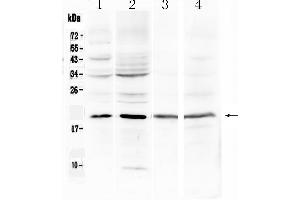 Western blot analysis of Myoglobin using anti-Myoglobin antibody . (MB Antikörper  (N-Term))