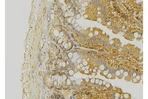 ABIN6276324 at 1/100 staining Mouse colon tissue by IHC-P. (KRT20 Antikörper  (C-Term))