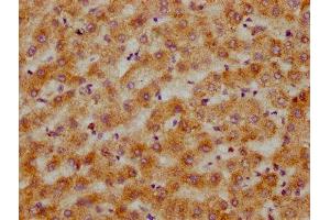 IHC image of ABIN7148519 diluted at 1:200 and staining in paraffin-embedded human liver tissue performed on a Leica BondTM system. (Copine III Antikörper  (AA 297-442))