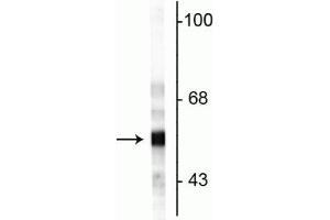 Western blot of rat cerebellar lysate showing specific immunolabeling of the ~57 kDa peripherin protein. (Peripherin Antikörper)