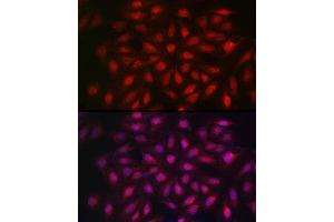 Immunofluorescence analysis of U2OS cells using KPNB1 Rabbit pAb (ABIN6134722, ABIN6142997, ABIN6142998 and ABIN6224723) at dilution of 1:100 (40x lens). (KPNB1 Antikörper  (AA 250-350))