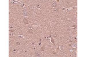 Immunohistochemistry (IHC) image for anti-Sushi-Repeat Containing Protein, X-Linked (SRPX) (N-Term) antibody (ABIN1031585)
