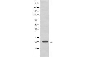 Western blot analysis of extracts from HeLa cells using RPL10L antibody. (RPL10L Antikörper  (C-Term))