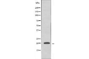 RPL10L Antikörper  (C-Term)