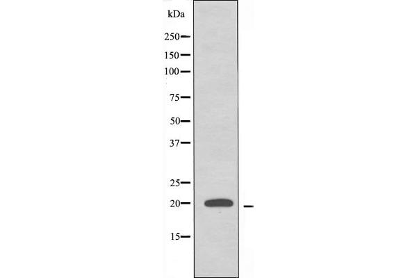 RPL10L Antikörper  (C-Term)