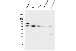 Western blot analysis of XRCC4 using anti-XRCC4 antibody (ABIN7599055).